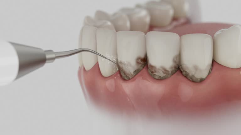 Reliable Emergency Dentist contractor in Mount Carmel, IL by Smile Center Dentistry